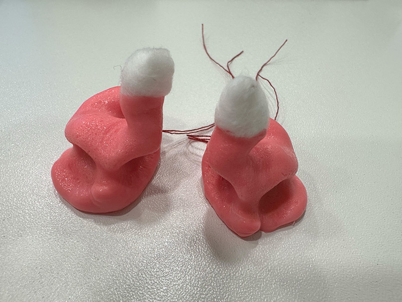 Abdruck vom Gehörgang